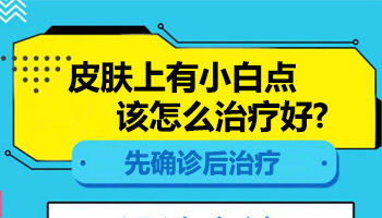 19岁女孩身上有小白点用什么方法治