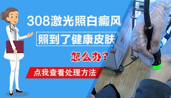 美国治白癜风的308激光多少钱一台