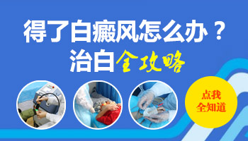 34岁女性腿部白斑怎么治