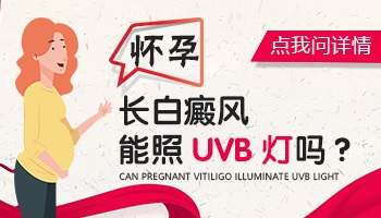 怀孕后得了白癜风能照uvb吗