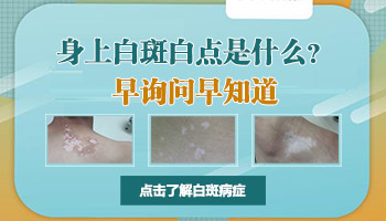 生完孩子后手腕长白点是不是白癜风