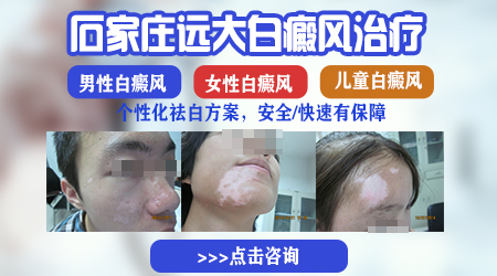 女性大腿根和腰部淡白色斑点扩散了怎么办