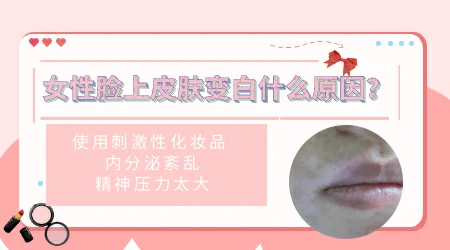 女性使用美白产品后脸上出现白斑怎么办