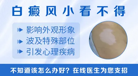 女性隐私部位变白是挂妇科还是皮肤科