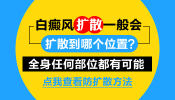 白癜风会扩散到其他部位吗