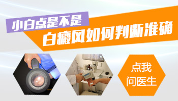 女性长白点自己如何判断是不是白癜风
