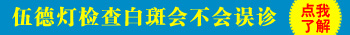 伍德灯照射白斑显示蓝白光就一定是白癜风吗