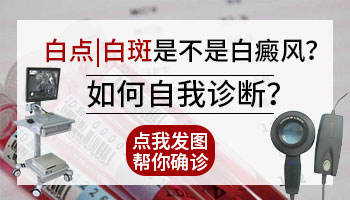 下巴右侧有一团很白的皮肤会不会是白癜风