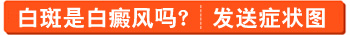 白斑做伍德灯检查医生说是白癜风准确吗