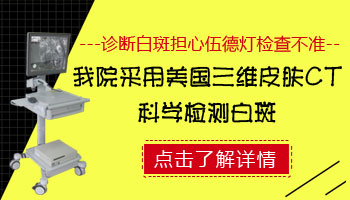 伍德灯下显示白斑是亮白色是不是白癜风