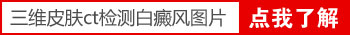 皮肤ct检查白癜风基底层色素轻度减少