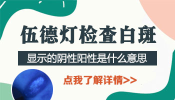 白斑做检查显示阳性什么意思