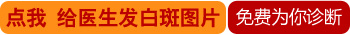 右耳朵发现两个白点如何判断是不是白癜风