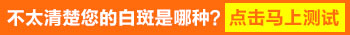 儿童白斑两次做伍德灯结果不一样