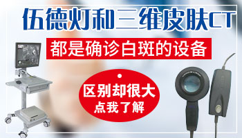 眼睛周边有白斑做检查能照伍德灯吗