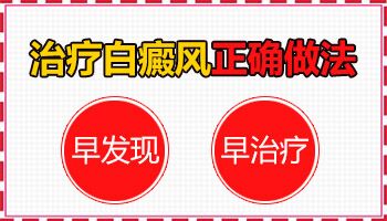 伍德灯照白癜风隐形斑点会长出来吗