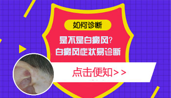 白斑发现两个月了无变化是不是白癜风