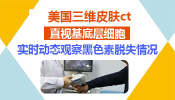 白斑做美国三维皮肤ct多少钱