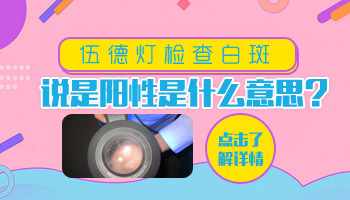 伍德氏灯检查白斑显示阳性会不会是白癜风
