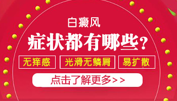 检查白斑有点像是白癜风怎么判断是不是