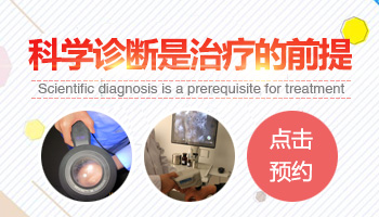 腰部和大腿内侧有白斑是不是白癜风怎么判断