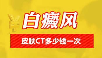 皮肤ct检查白斑多少钱 ct检查白斑结果怎么看