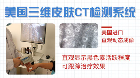 伍德镜检查淡蓝白色是白癜风吗