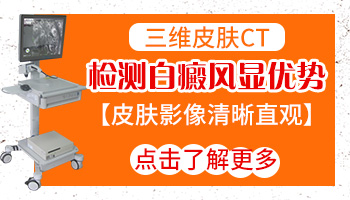 伍德灯检查有荧光就是不好吗 怎么确诊白癜风