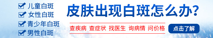 日晒白斑是什么样子 和白癜风有什么区别