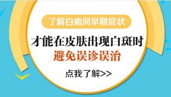 辨别早期白癜风白斑的标准