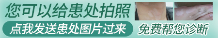 额头上有一小块背上也长了一块怎么回事