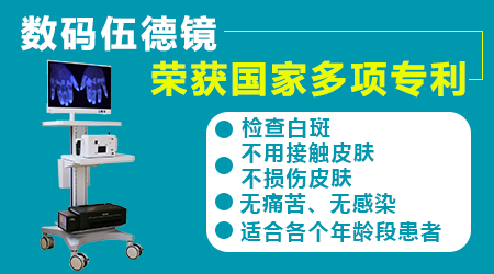 伍德镜下白斑浅蓝白色白斑是白癜风吗