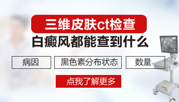 伍德镜下各种白斑颜色都代表什么