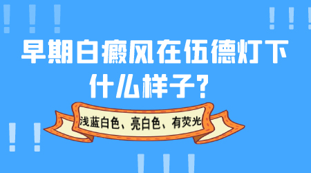 伍德灯下如何判定白斑是不是白癜风