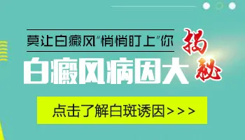 不确定是不是白癜风做哪些检查