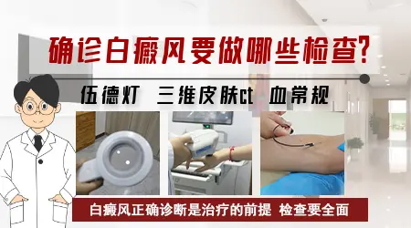 白点是白癜风吗 确诊白斑做什么检查