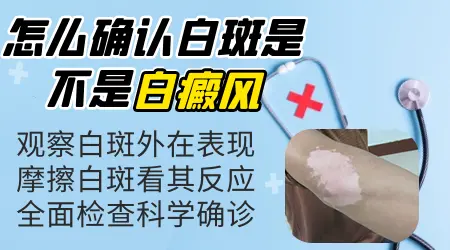 白点是白癜风吗 确诊白斑做什么检查