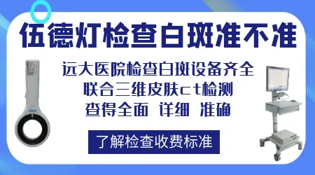 伍德灯下手指有白点