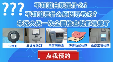 白斑做了伍德灯检查还有必要做皮肤ct吗