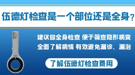 伍德灯下白斑图片 白癜风在伍德灯下照片