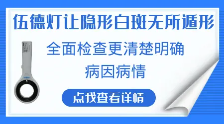 肉眼看不到的白斑伍德灯能照见吗