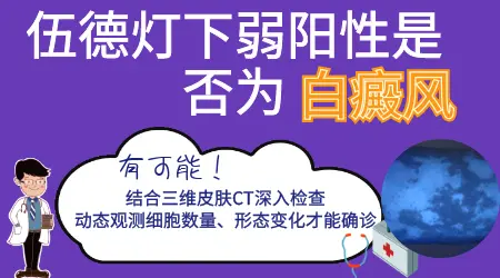 伍德灯检查白斑弱阳性可以排除白癜风吗