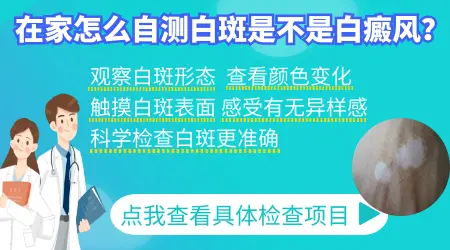 自己在家怎么测白斑种类