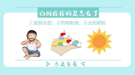 脸上起皮发痒有可能会是白癜风吗