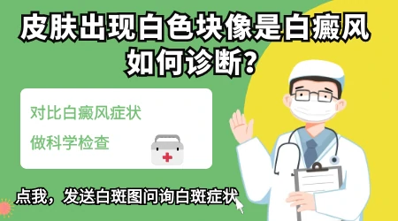 如何判断是否得了白癜风