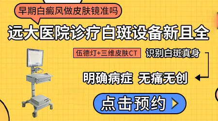 皮肤镜和伍德灯两项检测能确定白癜风吗