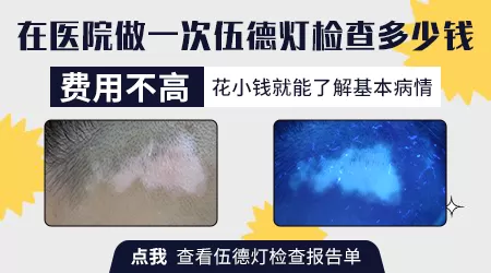 检查白斑病大概价格