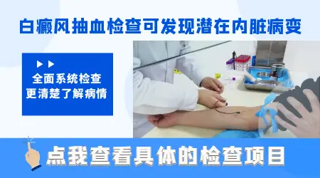 白斑检查一般需要做哪些项目