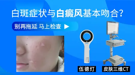 伍德灯检查结果灰白色荧光可能是什么情况