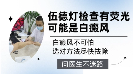 伍德灯检查结果灰白色荧光可能是什么情况
